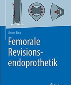 Femorale Revisionsendoprothetik (German Edition) 1. Aufl. 2021 Edition