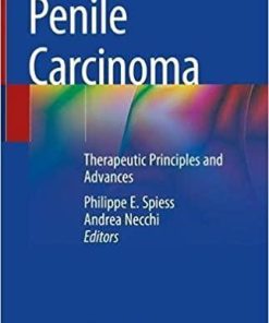 Penile Carcinoma: Therapeutic Principles and Advances 1st ed. 2021 Edition