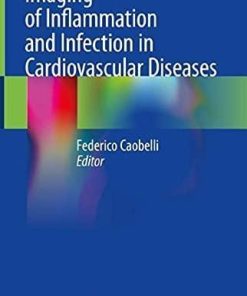 Imaging of Inflammation and Infection in Cardiovascular Diseases