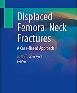 Displaced Femoral Neck Fractures: A Case-Based Approach 1st ed. 2022 Edition