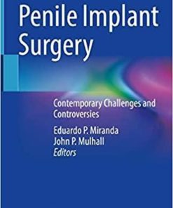 Penile Implant Surgery: Contemporary Challenges and Controversies 1st ed. 2022 Edition