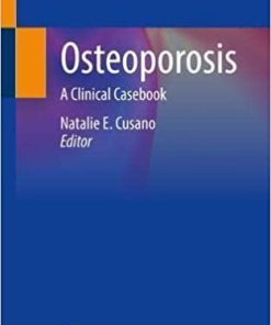 Osteoporosis: A Clinical Casebook 1st ed. 2021 Edition