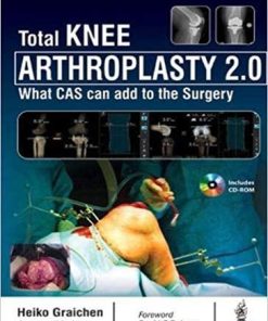 Total Knee Arthroplasty 2.0: What CAS can add to the Surgery 1st Edition