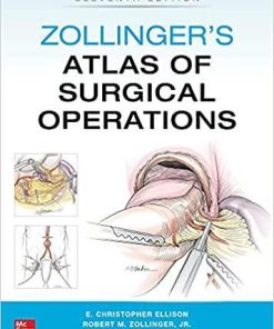 Zollinger’s Atlas of Surgical Operations, Eleventh Edition 11th Edition