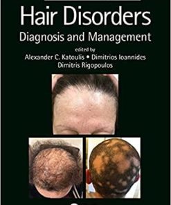 Hair Disorders: Diagnosis and Management (Series in Dermatological Treatment) 1st Edition