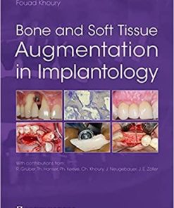 Bone and Soft Tissue Augmentation in Implantology