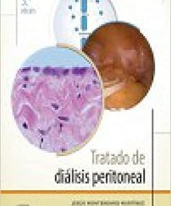 Tratado de diálisis peritoneal (3ª ed.) (Spanish Edition)