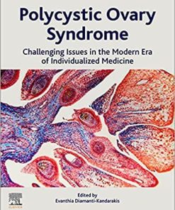 Polycystic Ovary Syndrome: Challenging Issues in the Modern Era of Individualized Medicine 1st Edition