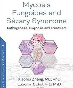 Mycosis Fungoides: Causes, Diagnosis and Treatment Hardcover