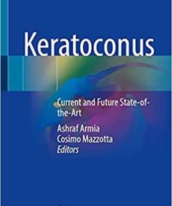 Keratoconus: Current and Future State-of-the-Art 1st ed. 2022 Edition