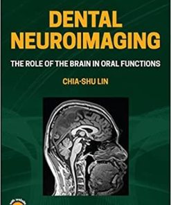 Dental Neuroimaging: The Role of the Brain in Oral Functions 1st Edition