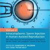 Manual of Intracytoplasmic Sperm Injection in Human Assisted Reproduction 1st Edition