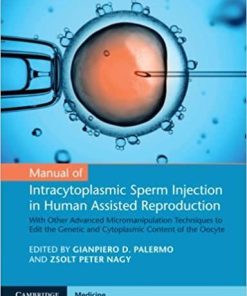 Manual of Intracytoplasmic Sperm Injection in Human Assisted Reproduction 1st Edition