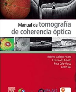 Manual De Tomografia De Coherencia Optica