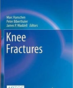 Knee Fractures (Strategies in Fracture Treatments) 1st ed. 2021 Edition