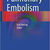 Pulmonary Embolism 1st ed. 2022 Edition