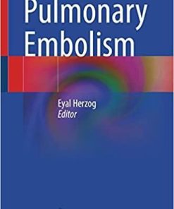 Pulmonary Embolism 1st ed. 2022 Edition