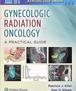 Gynecologic Radiation Oncology: A Practical Guide 1st Edition