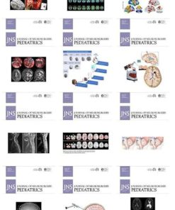 Journal of Neurosurgery: Pediatrics 2021 Full Archives