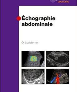 Echographie Abdominale (Imagerie Medicale Diagnostic) (French Edition) 1st Edition