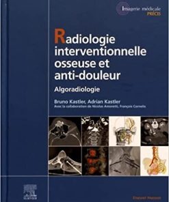 Radiologie Interventionnelle osseuse et anti-douleur: Algoradiologie