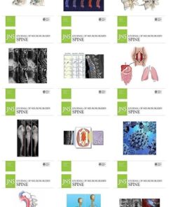 Journal of Neurosurgery: Spine 2021 Full Archives