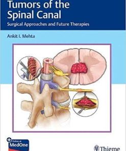 Tumors of the Spinal Canal: Surgical Approaches and Future Therapies 1st Edition