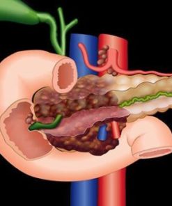 Imaging Mastery Series: Pancreas Imaging 2021