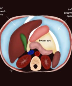 Imaging Mastery Series: Peritoneum and Mesentery 2021