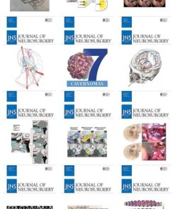 Journal of Neurosurgery 2021 Full Archives