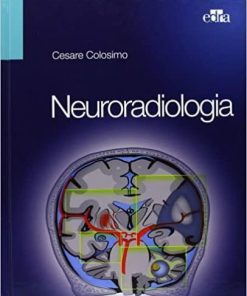 Neuroradiologia