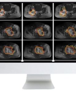 Crossroads of Computational Science and Musculoskeletal Imaging: Where Machine Magic Can Aid Radiologists 2021