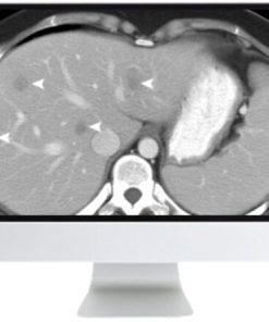 SAR Disease-Focused Panels: Cancer Imaging and Reporting Guidelines 2021