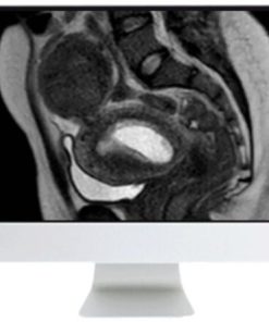 ARRS Abdominal MRI: Practical Applications and Advanced Imaging Techniques 2021