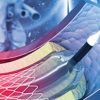 Comprehensive Review and Update of What’s New in Vascular and Endovascular Surgery 2021