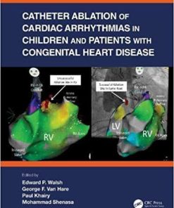 Catheter Ablation of Cardiac Arrhythmias in Children and Patients with Congenital Heart Disease 1st Edition