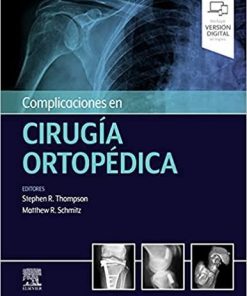 Complicaciones en cirugía ortopédica: Medicina deportiva