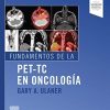 Fundamentos de la PET-TC en oncología (Spanish Edition)