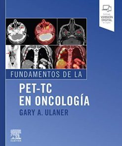 Fundamentos de la PET-TC en oncología (Spanish Edition)