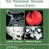 Atlas of Imaging of the Paranasal Sinuses, Second Edition 2nd Edition