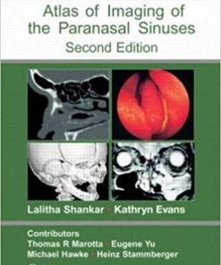 Atlas of Imaging of the Paranasal Sinuses, Second Edition 2nd Edition