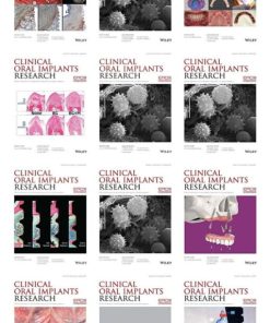 Clinical Oral Implants Research 2021 Full Archives