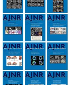 American journal of Neuroradiology 2021 Full Archives