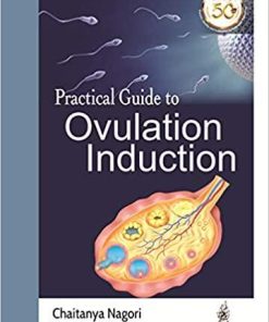 Practical Guide to Ovulation Induction