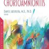 Chorioamnionitis