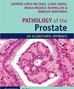 Pathology of the Prostate: An Algorithmic Approach 1st Edition