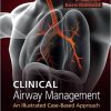 Clinical Airway Management: An Illustrated Case-Based Approach 1st Edition