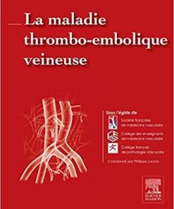 La maladie thrombo-embolique veineuse