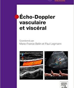 Echo-doppler Vasculaire et Visceral by Bellin Marie-france