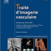 Traité D’imagerie Vasculaire (Imagerie médicale : Précis) (French Edition)